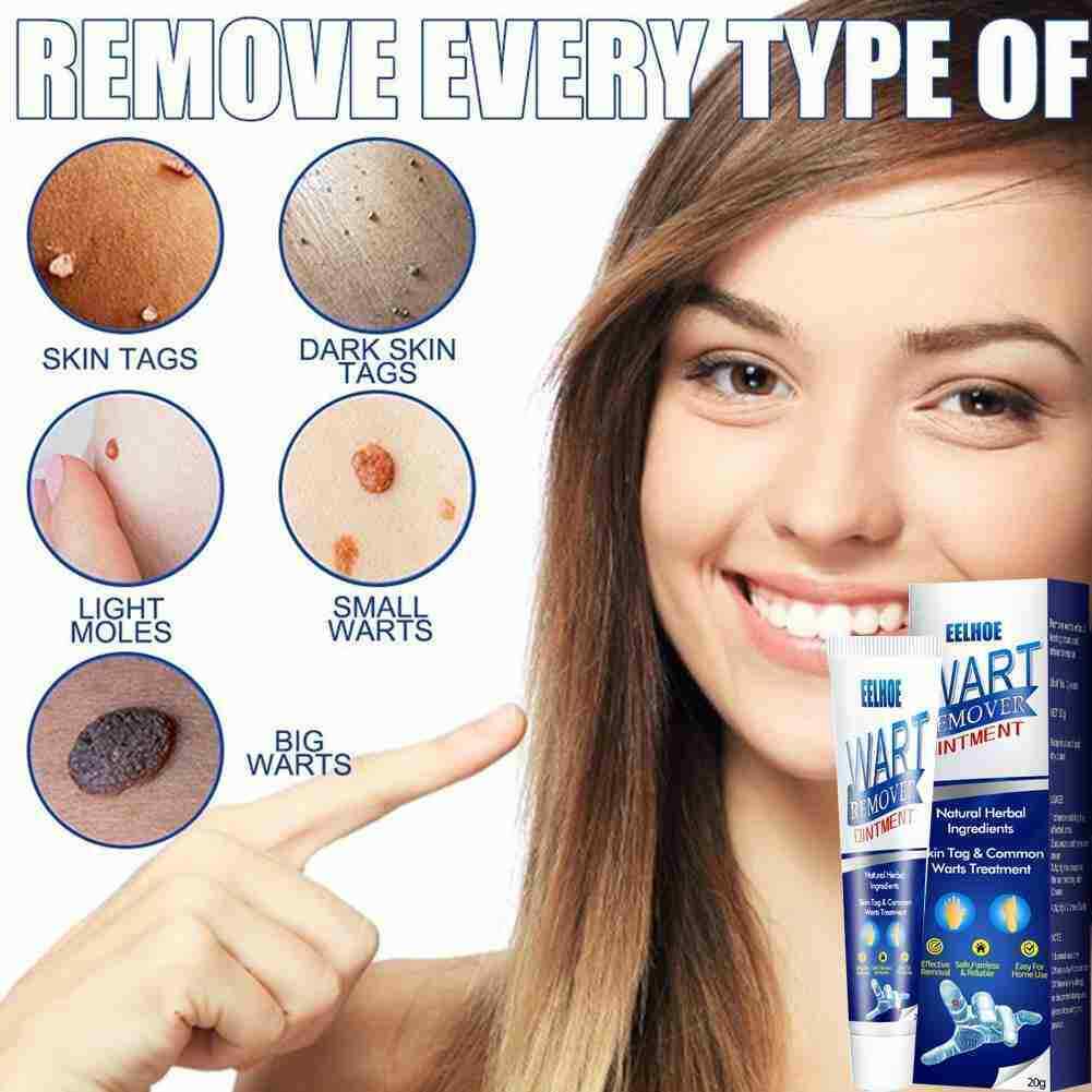 Instant Blemish Removal Gel Body Warts Remover Treatment Cream Skin Tag Care