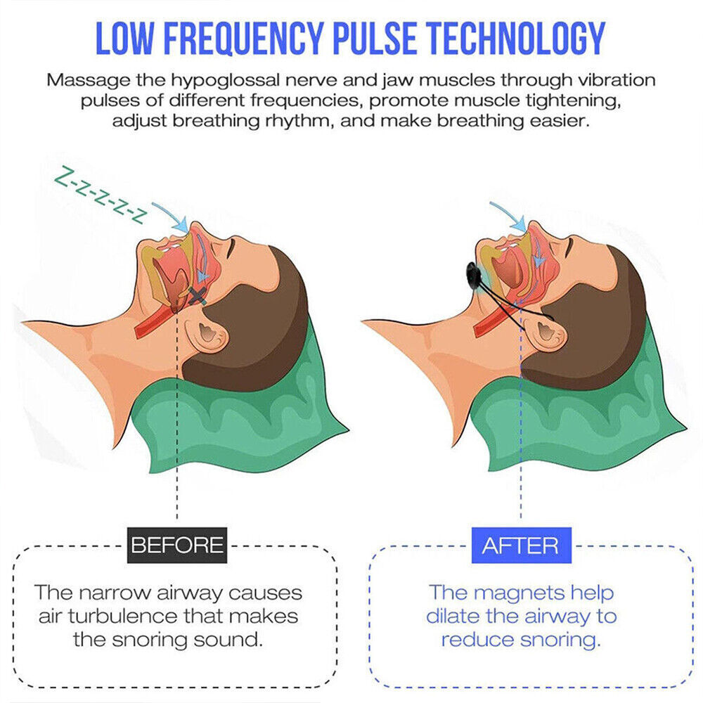 Snore Circle Anti-Snoring Chin Device Snoring Stopper Muscle Tightening Tool