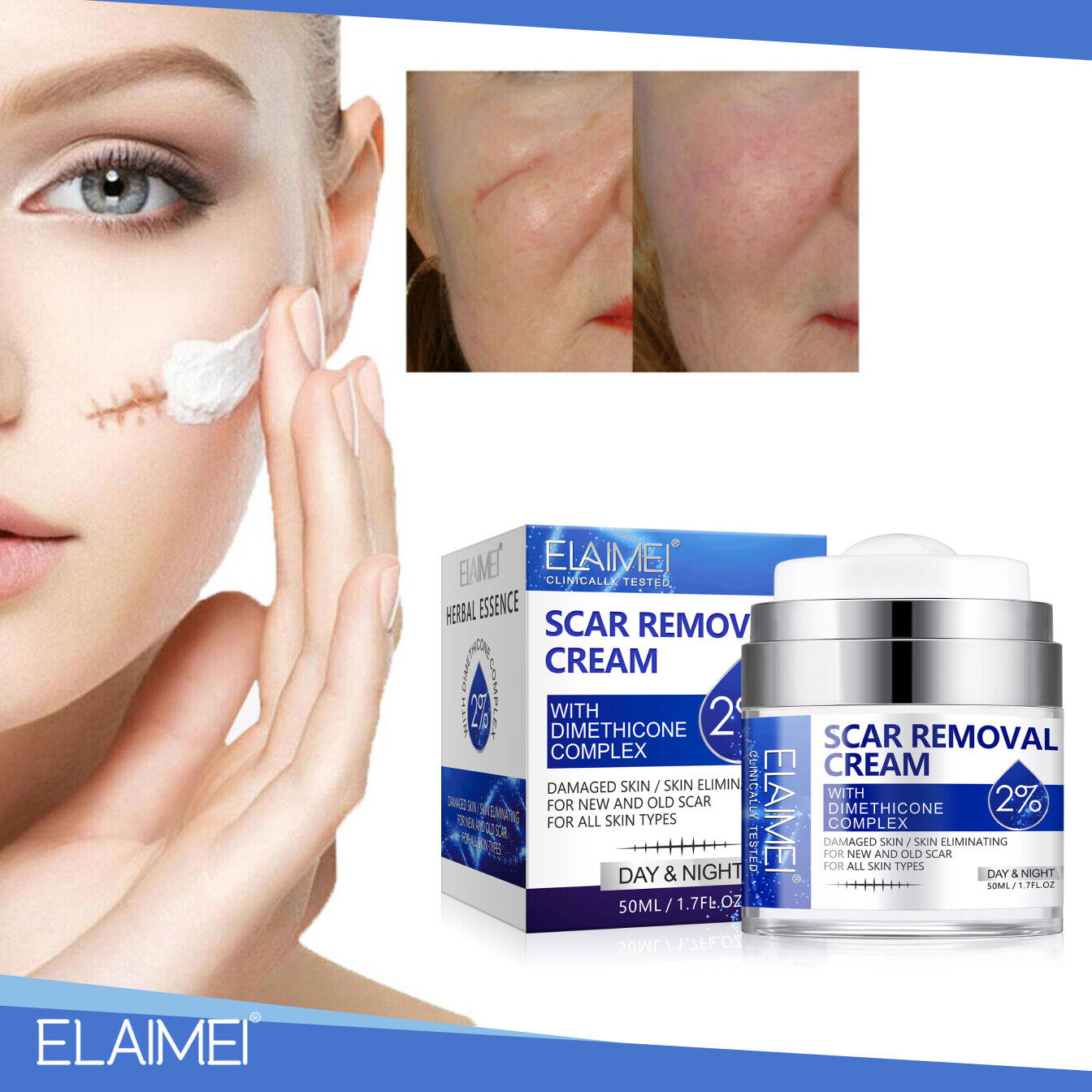 Scar Removal Cream Advanced Scar Treatment Gel Stretch Marks Acne Skin Repair