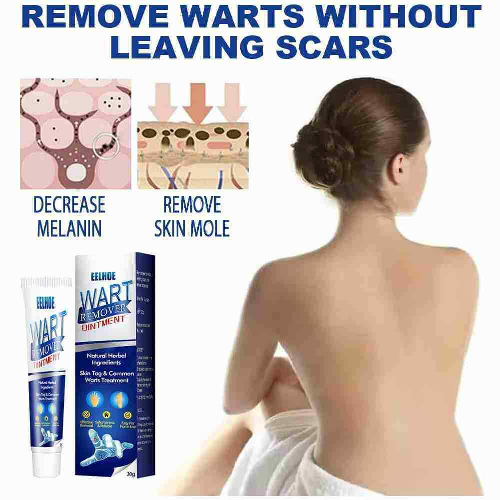 Instant Blemish Removal Gel Body Warts Remover Treatment Cream Skin Tag Care