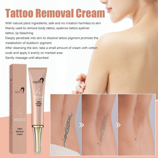 Tattoo Removal Cream Permanent Removal Of Tattoos Tattoo Removal Cream