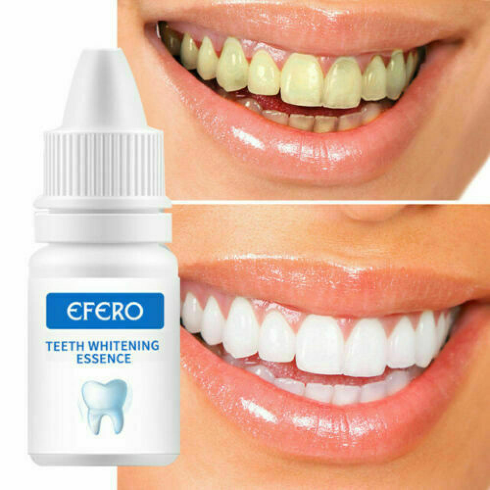 NEW INSTANT TOOTH WHITENING KIT WHITE TEETH CLEAN GEL UV BLEACH DENTAL STRENGTH