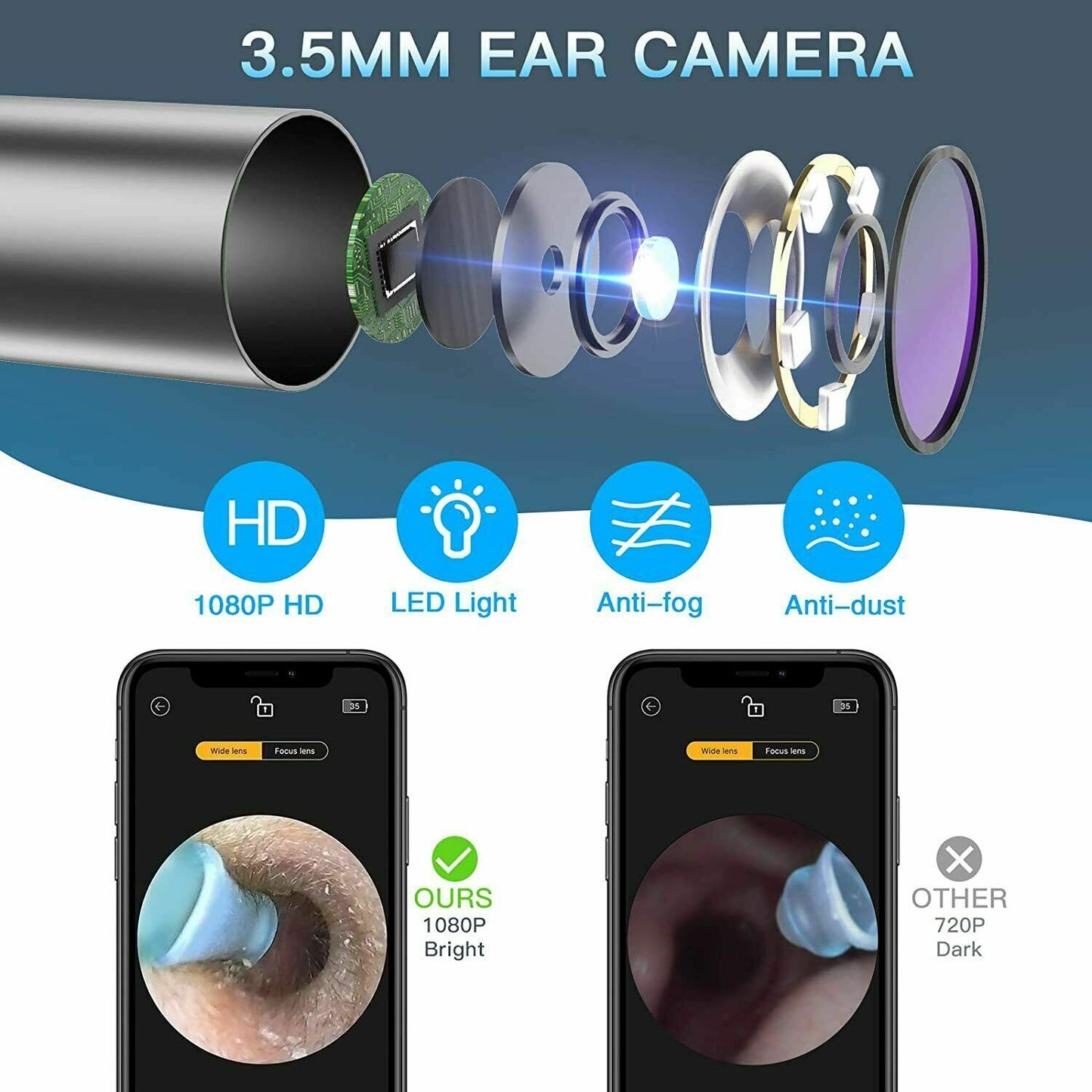 Bebird Ear Wax Removal Ear Camera Cleaning Endoscope Spoon Mini Ear Picker 1080P