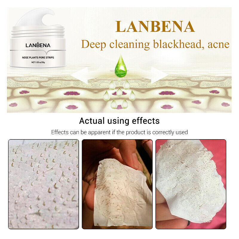 LANBENA 60PCS Pore Strips Blackhead Remover Nose Acne Clean