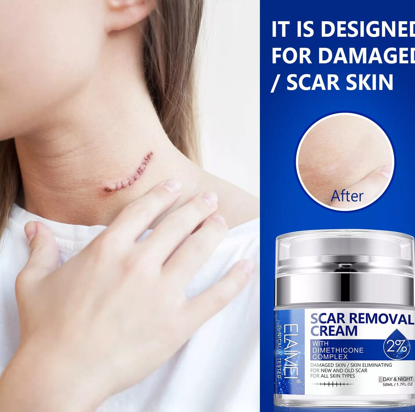 Scar Removal Cream Advanced Scar Treatment Gel Stretch Marks Acne Skin Repair