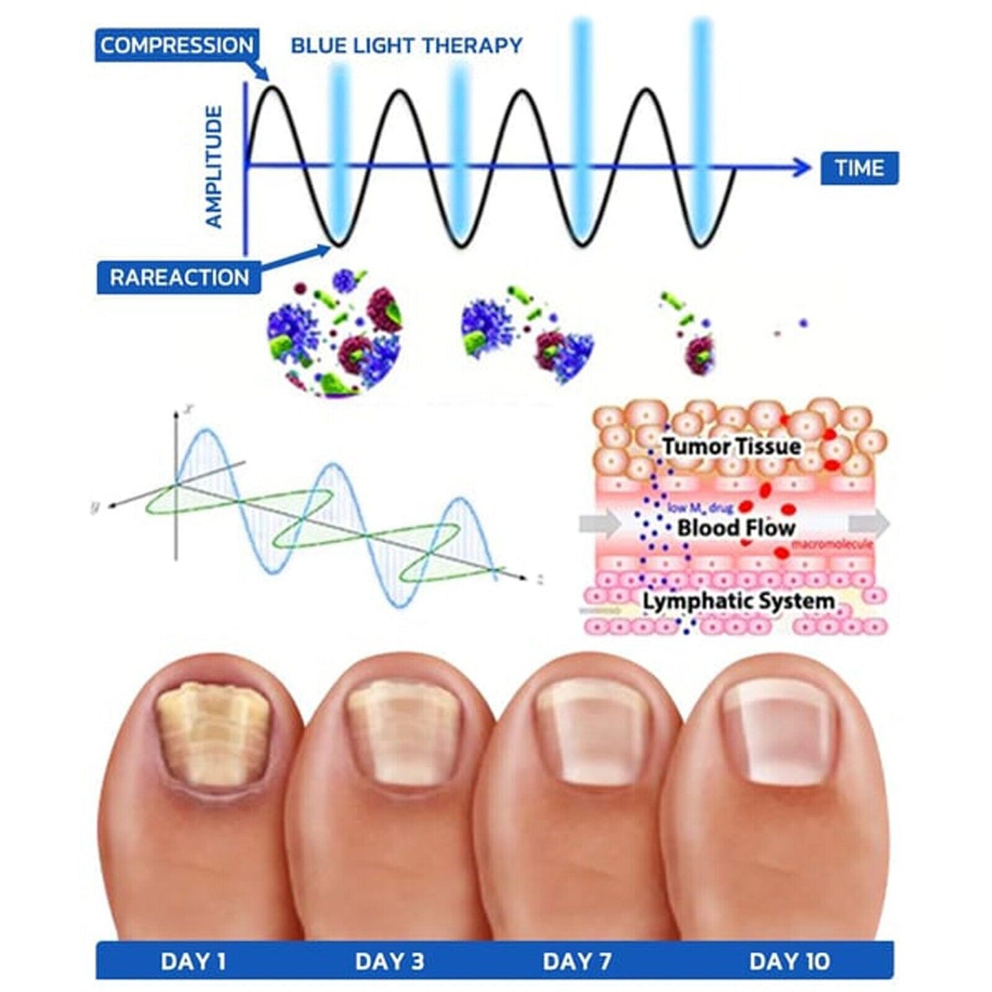 Nail Fungus Laser Device Light Therapy Onychomycosis Toes Treatment HOT