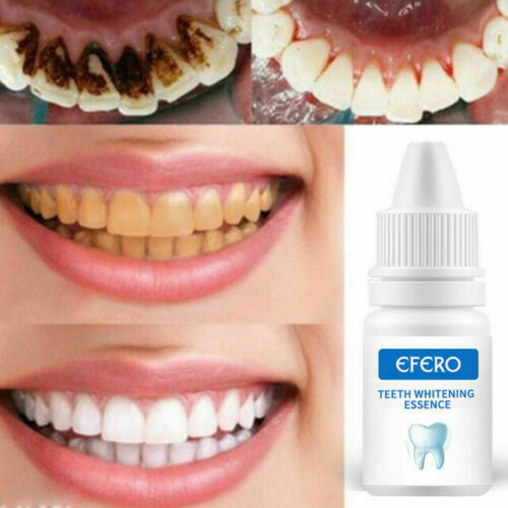 NEW INSTANT TOOTH WHITENING KIT WHITE TEETH CLEAN GEL UV BLEACH DENTAL STRENGTH