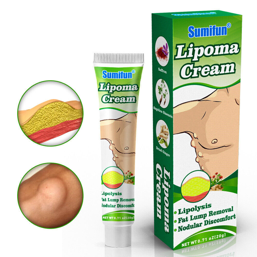 1 x Lipoma Cream Fat Lump Removal Treatment Skin Swelling Exfoliating Ointment