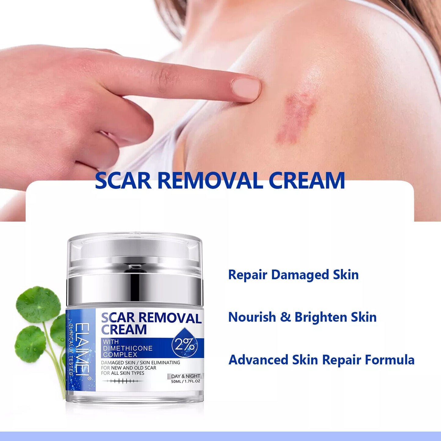 Scar Removal Cream Advanced Scar Treatment Gel Stretch Marks Acne Skin Repair