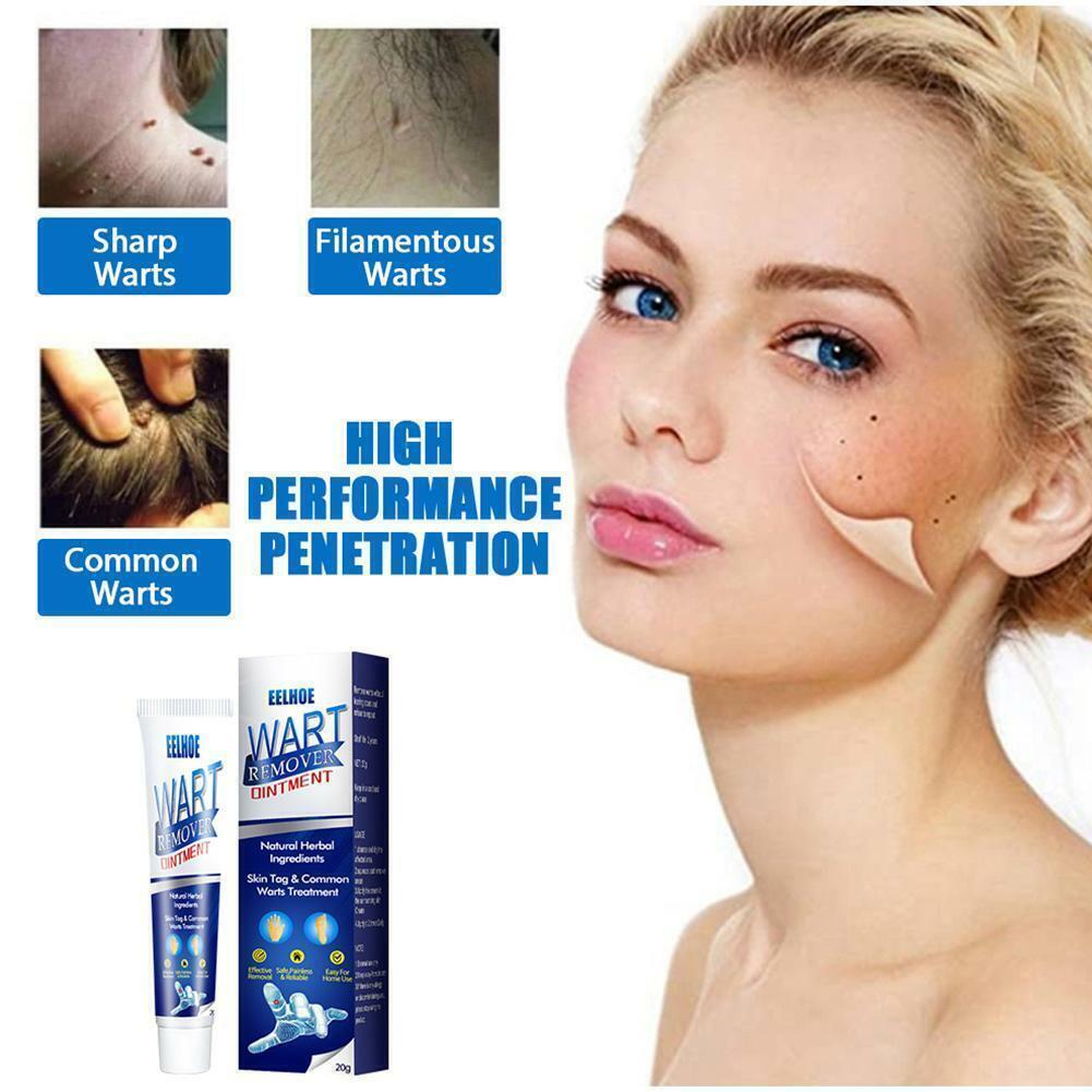 Instant Blemish Removal Gel Body Warts Remover Treatment Cream Skin Tag Care