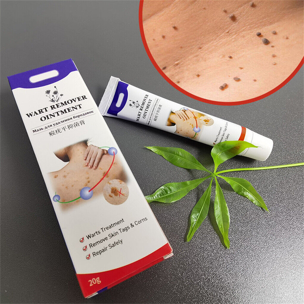 Wart Removal Treatment Cream Body Warts Treatment Cream Skin Tag Remover