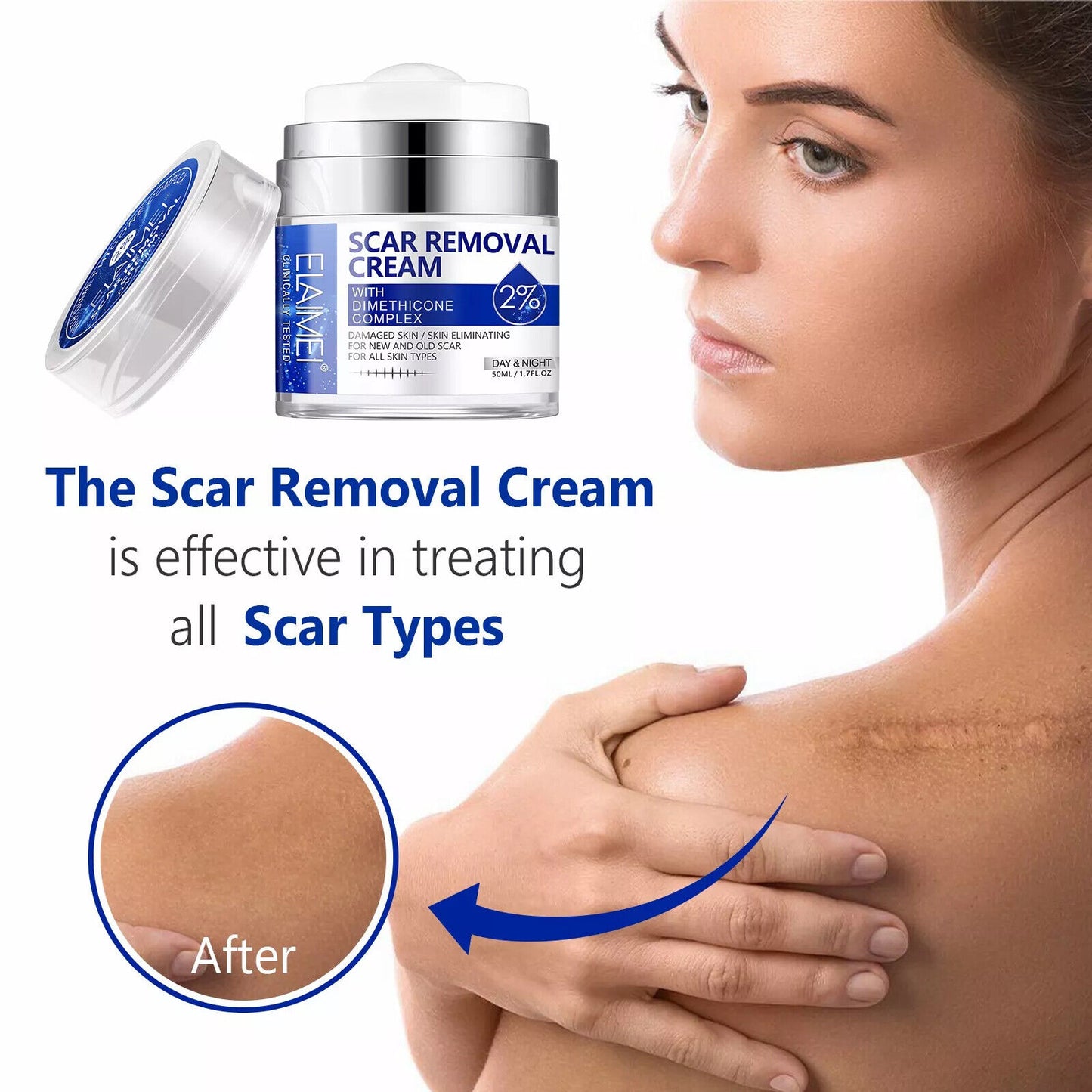 Scar Removal Cream Advanced Scar Treatment Gel Stretch Marks Acne Skin Repair