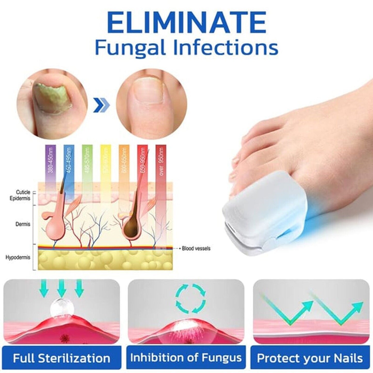 Nail Fungus Laser Device Light Therapy Onychomycosis Toes Treatment HOT