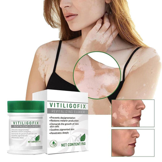 Vitiligo Fix Revitalize Elixir, Treatment Cream, Treat Vitiligo Soothing Cream