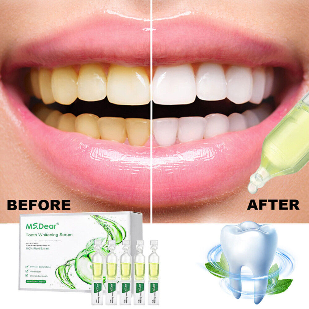 TLOPA Ampoule Toothpaste, Ampoule Tooth Serum, Tartar Plaque Removal Toothpaste