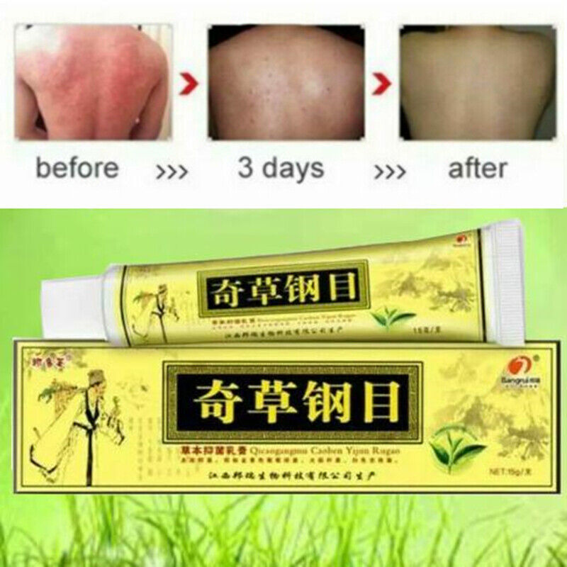 3Pack ORIGINAL ADVANCED PSORIASIS &ECZEMA NATURAL CREAM 100% Original